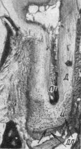 Продольный срез третьего нижнего коренного зуба полевой мыши V возрастной группы. Окраска — гематоксилин.