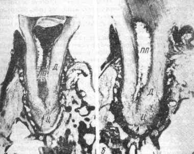 Продольные срезы третьих нижних коренных зубов полевых мышей V возрастной группы. Окраска — гематоксилин