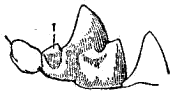 Хищнический зуб нижней челюсти перевязки
