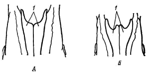 Передняя часть носовых костей волка (А) и шакала (Б)