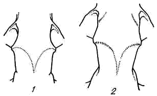 Различия в строении черепа лесного (1) и степного (2) хорька   в области заглазничного сужения (по И.И. Соколову, 1963)