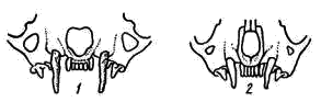 Различия в строении черепа горностая (1) и ласки (2) в лицевой части — по подглазничным отверстиям